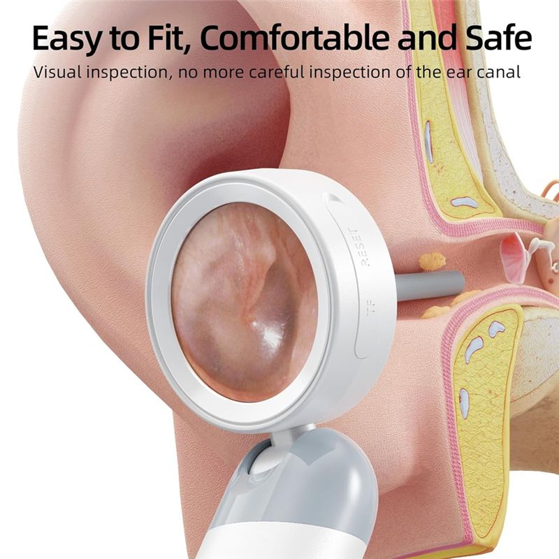 LXYB18B Wireless Ear Otoscope  - Photography Lighting Diagram 评论和价格