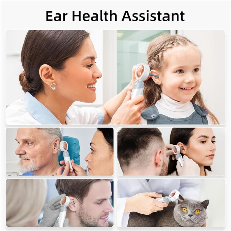 LXYB18B Wireless Ear Otoscope  - Photography Lighting Diagram 评论和价格
