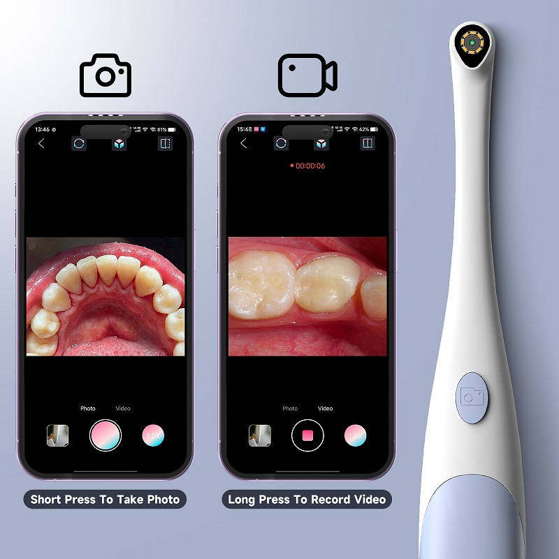 Oral Endoscope Camera 1440P Ph - Photography Lighting Diagram 评论和价格