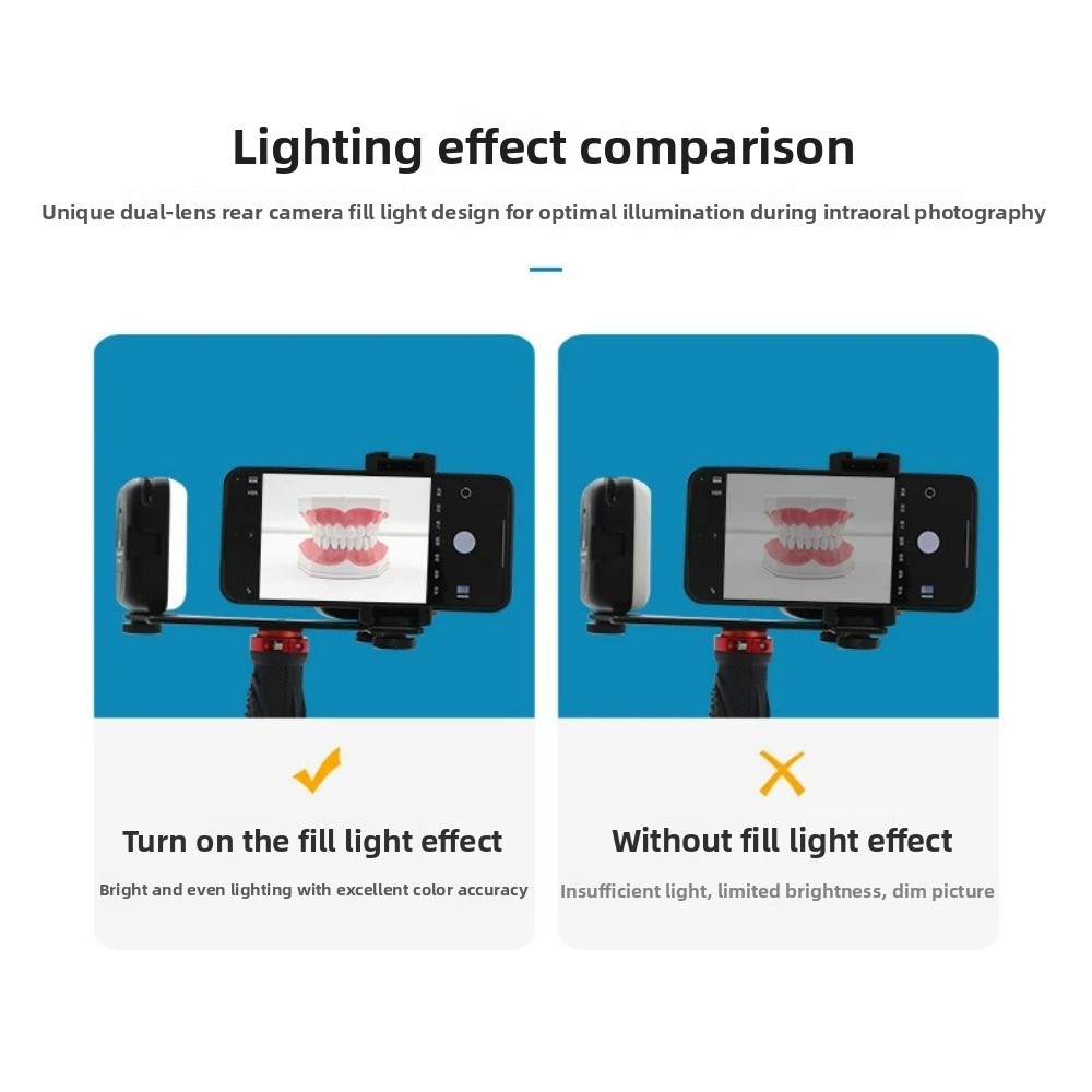 Dental Photography Light, Blue - Photography Led Lighting Kit 评论和价格